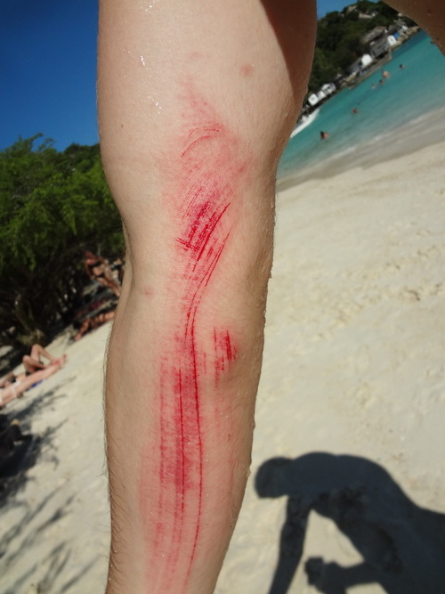 arm scratches shark bay